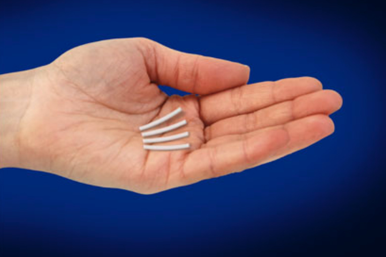 Advanced Spine & Pain Interventions is the First in Atlanta Georgia to Implant Probuphine!