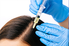 prp hair restoration